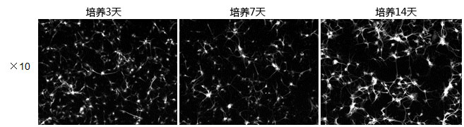 神经细胞用培养基