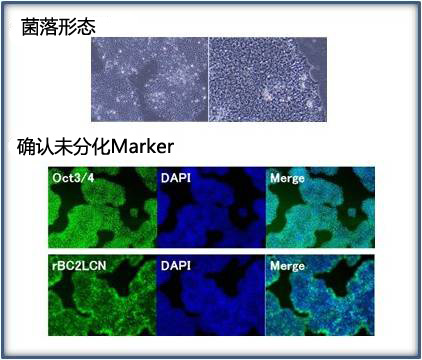 玻璃粘连蛋白(20-398aa),人, 重组体, 溶液