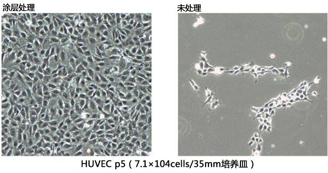 cellnest人Ⅰ型重组胶原蛋白肽