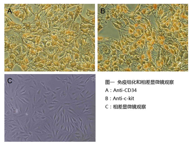 胃肠道间质瘤-T1培养套装