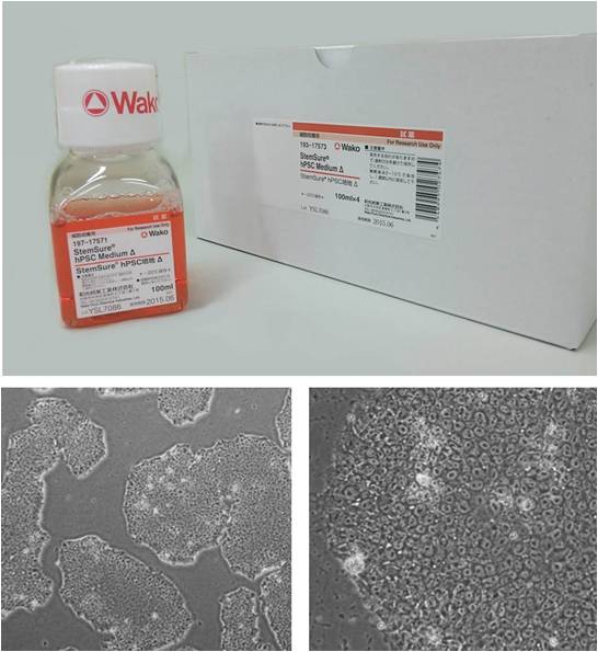 人多能性干细胞无血清培养基