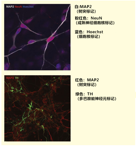 人iPS细胞源神经细胞/浦肯野细胞培养