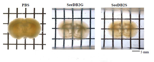 SeeDB2