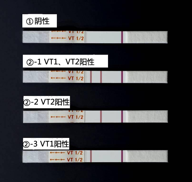 NH免疫层析VT1/2