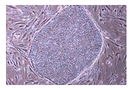 灵长类ES/iPS细胞用培养基