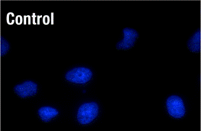 NBR1 ELISA kit