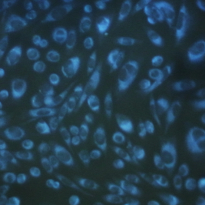 CytoSeeing（Reversible Cytoplasm Blue）