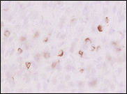 磷酸化α- 突触核蛋白抗体(pSyn#64)