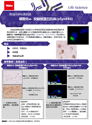 磷酸化α- 突触核蛋白抗体(pSyn#64)
