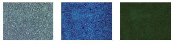 α-突触核蛋白聚集检测试剂盒