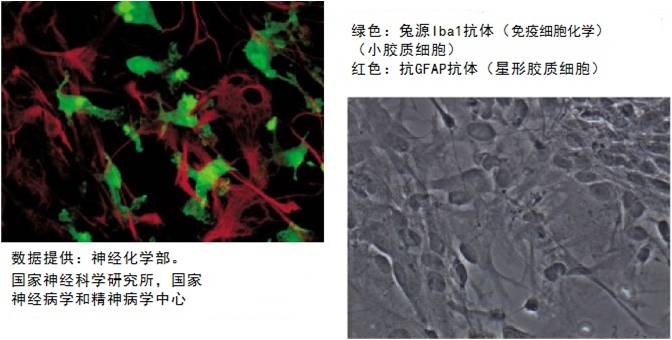 兔源Iba1抗体，无标签