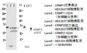 抗磷酸化CRMP1/2（Ser522），兔