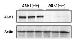 抗ASK1，单克隆抗体