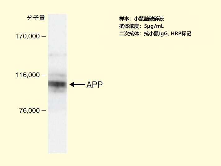 抗淀粉样蛋白前驱体蛋白