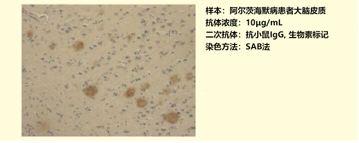 抗淀粉样蛋白前驱体蛋白