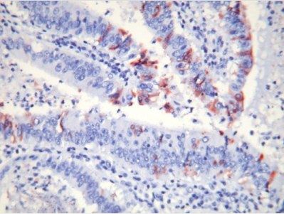 细胞凋亡M30 CytoDEATH™ 抗体