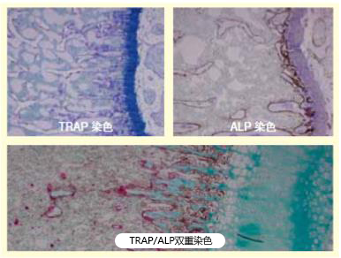 TRAP/ALP染色试剂盒