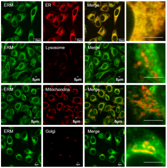 ER-Protein Capture Kit