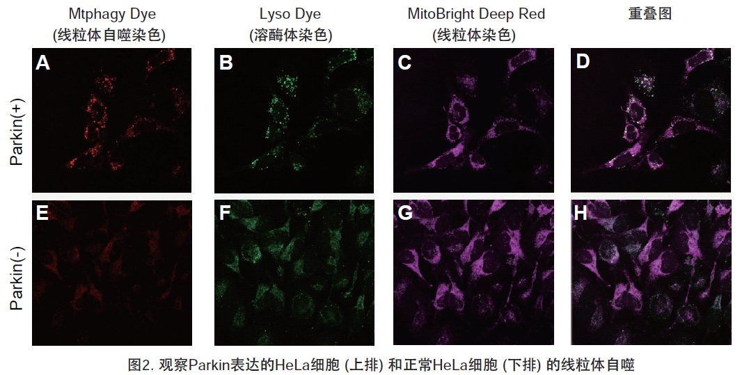 线粒体自噬—Mitophagy Detection Kit货号：MD01