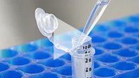 AAVpro® Purification Kit (AAV2)