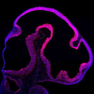 Neural Progenitor Cell Antibodies