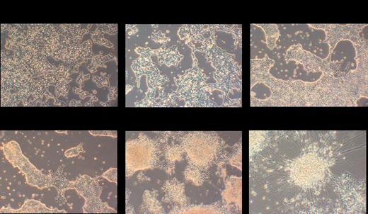 Mouse Neural Differentiation Media (Ndiff 227)