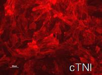 Human Stem Cell Derived Cardiomyocytes