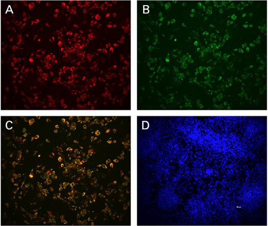 Human Stem Cell Derived Beta Cells