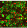 Human Stem Cell Derived Beta Cells