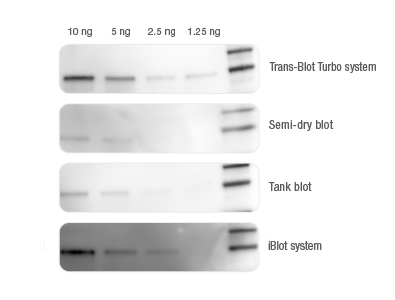 美国伯乐全能型蛋白转印系统1704150Trans-Blot Turbo