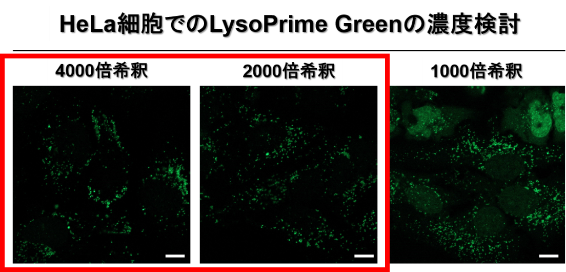 リソソーム染色色素 Green LysoPrime Green - High Specificity and pH Resistance 同仁化学研究所