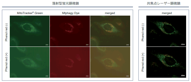 マイトファジー検出キット Mitophagy Detection Kit 同仁化学研究所