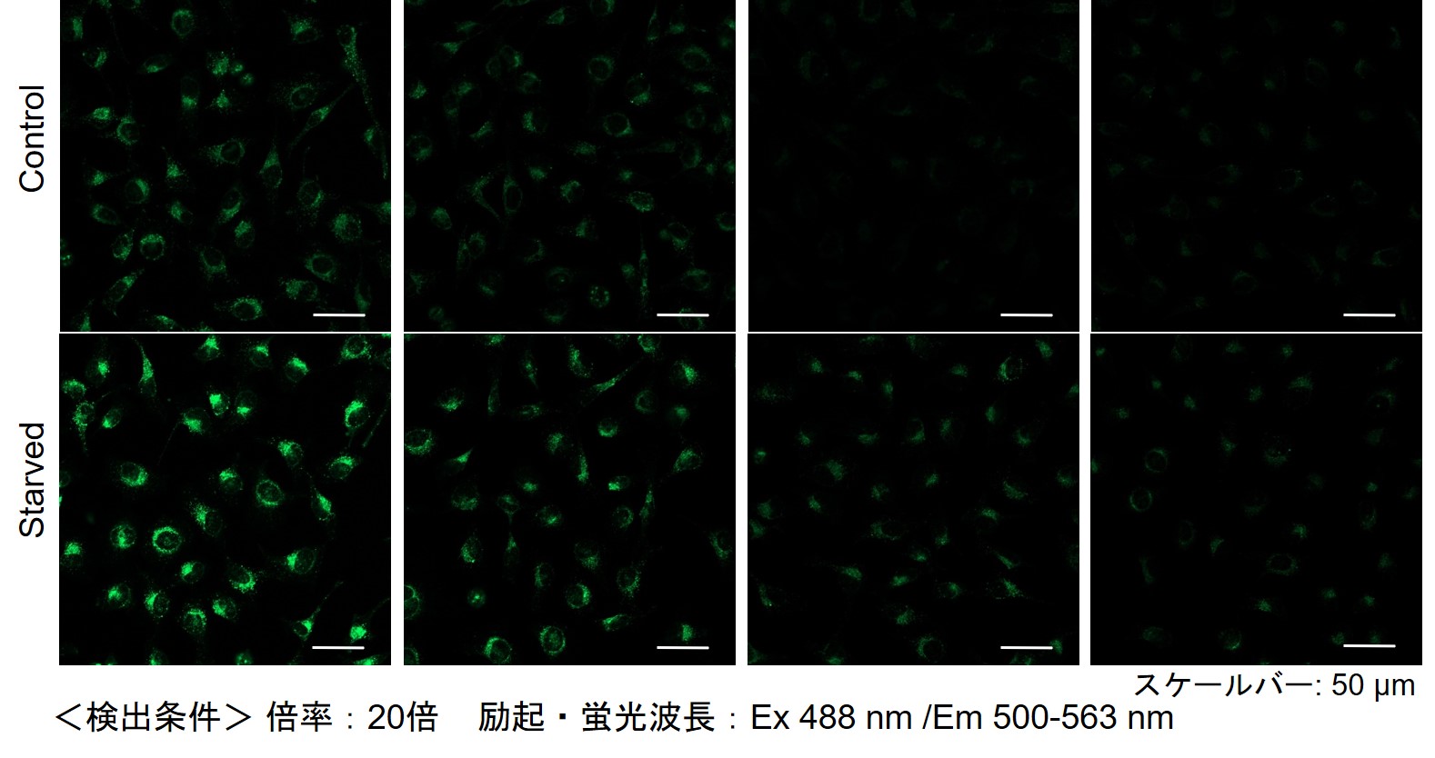 オートファジー（オートファゴソーム）の検出試薬 DAPGreen - Autophagy Detection 同仁化学研究所