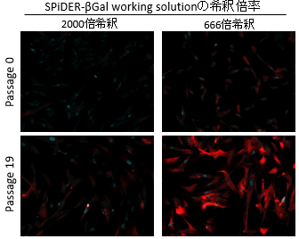 老化細胞検出キット Cellular Senescence Detection Kit - SPiDER-βGal 同仁化学研究所