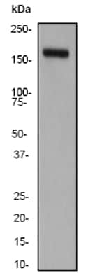 Anti-CD11b antibody EP1345Y CD11兔单克隆抗体abcam ab52478