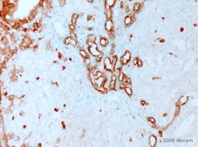 Anti-pan Cytokeratin antibody PCK-26 鼠单克隆[PCK-26abcam ab6401