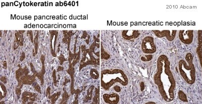 Anti-pan Cytokeratin antibody PCK-26 鼠单克隆[PCK-26abcam ab6401