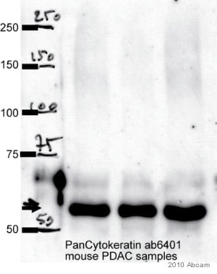 Anti-pan Cytokeratin antibody PCK-26 鼠单克隆[PCK-26abcam ab6401