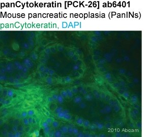 Anti-pan Cytokeratin antibody PCK-26 鼠单克隆[PCK-26abcam ab6401