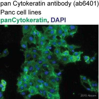 Anti-pan Cytokeratin antibody PCK-26 鼠单克隆[PCK-26abcam ab6401